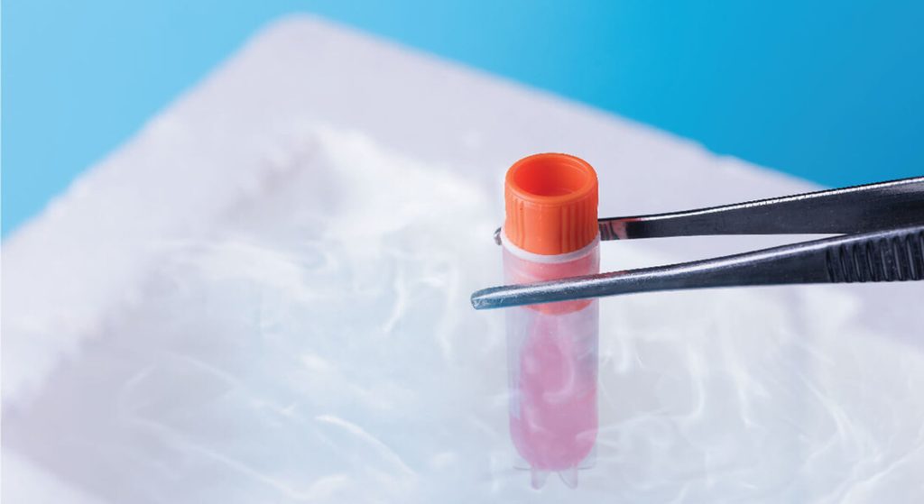 Egg Freezing at Gada IVF Indore